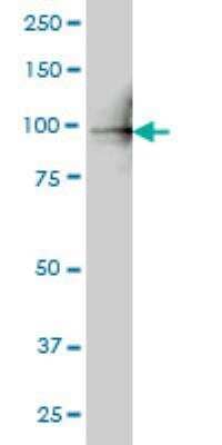 Western Blot: PLK4 Antibody (1C8) [H00010733-M01]