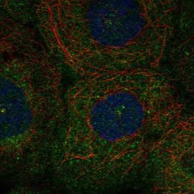 Immunocytochemistry/ Immunofluorescence: PLK4 Antibody [NBP2-55088]