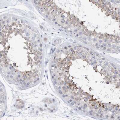 Immunohistochemistry-Paraffin: PLK4 Antibody [NBP1-87095]