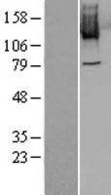 Western Blot: PLK4 Overexpression Lysate [NBL1-14518]