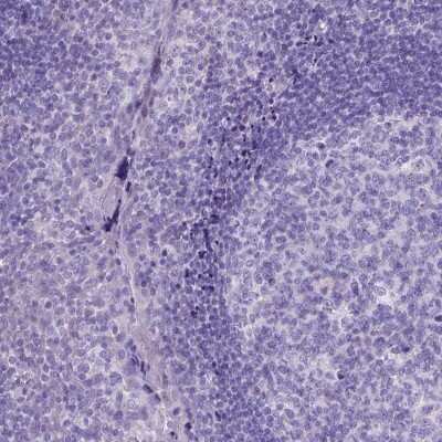 Immunohistochemistry-Paraffin: PLK5 Antibody [NBP2-48630]