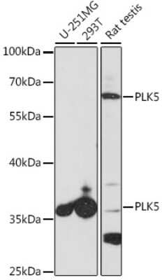 Western Blot: PLK5 AntibodyAzide and BSA Free [NBP2-94219]