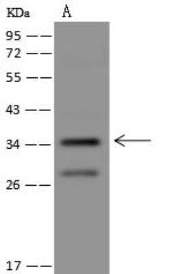 Western Blot: PLK5 Antibody [NBP3-12602]