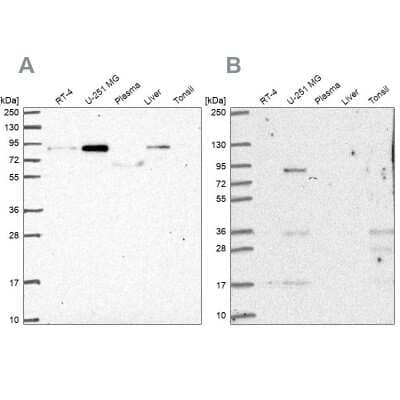 Western Blot: PLOD1 Antibody [NBP2-31885]