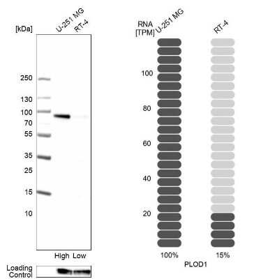 Western Blot: PLOD1 Antibody [NBP2-31885]
