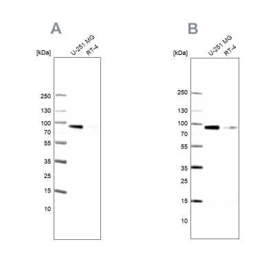 Western Blot: PLOD1 Antibody [NBP2-31885]