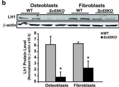 Western Blot: PLOD1 Antibody [NBP2-38770]