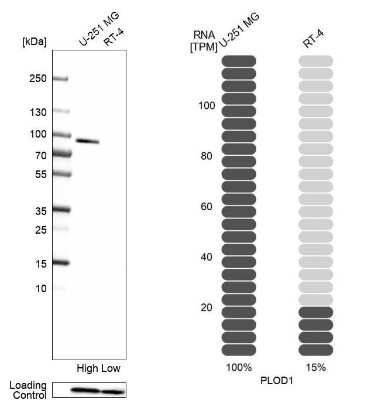 Western Blot: PLOD1 Antibody [NBP2-38770]