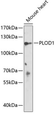 Western Blot: PLOD1 AntibodyBSA Free [NBP2-94781]