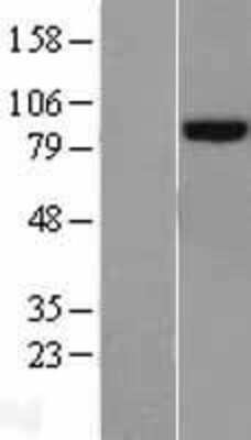 Western Blot: Lysine Hydroxylase 2/PLOD2 Overexpression Lysate [NBL1-14522]