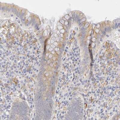 Immunohistochemistry-Paraffin: PLOD3 Antibody [NBP1-81307]