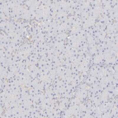 Immunohistochemistry-Paraffin: PLOD3 Antibody [NBP1-81307]