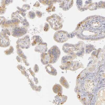 Immunohistochemistry-Paraffin: PLOD3 Antibody [NBP1-81307]