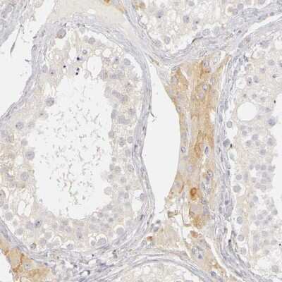 Immunohistochemistry-Paraffin: PLOD3 Antibody [NBP1-81307]