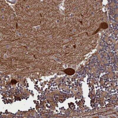 Immunohistochemistry: PLP2 Antibody [NBP1-89331]