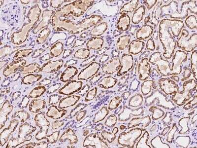 Immunohistochemistry: PLP2 Antibody [NBP3-06290]
