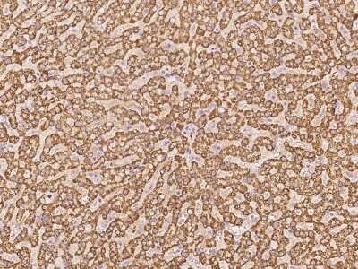 Immunohistochemistry-Paraffin: PLP2 Antibody [NBP3-06290]