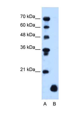 Western Blot: PLP2 Antibody [NBP1-62539]