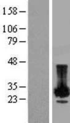 Western Blot: PLP2 Overexpression Lysate [NBP2-08081]