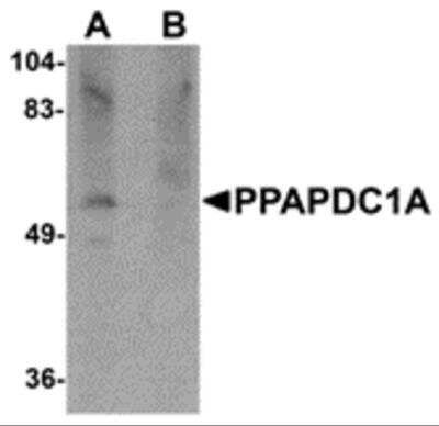 Western Blot: PLPP4/PPAPDC1A AntibodyBSA Free [NBP2-81931]