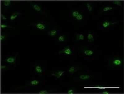 Immunocytochemistry/ Immunofluorescence: PLRG1 Antibody (7H2) [H00005356-M06]