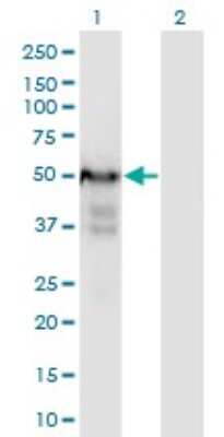 Western Blot: PLRG1 Antibody (7H2) [H00005356-M06]