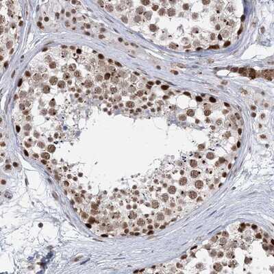 Immunohistochemistry-Paraffin: PLRG1 Antibody [NBP1-87225]