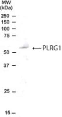 Western Blot: PLRG1 Antibody [NB100-853]