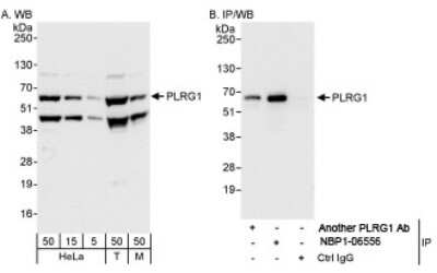 Western Blot: PLRG1 Antibody [NBP1-06556]