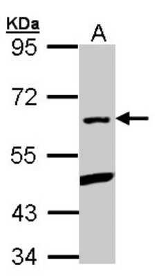 Western Blot: PLRG1 Antibody [NBP1-31265]