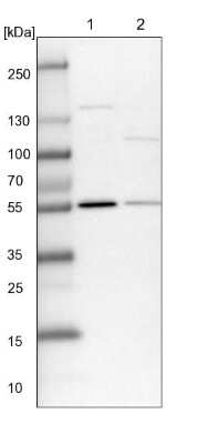 Western Blot: PLRG1 Antibody [NBP1-87225]