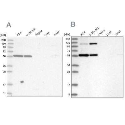 Western Blot: PLRG1 Antibody [NBP1-87225]