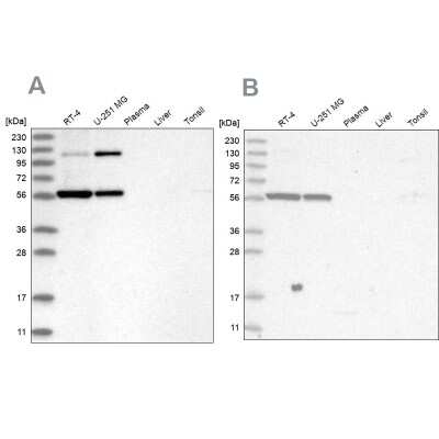 Western Blot: PLRG1 Antibody [NBP2-48650]