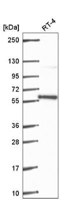 Western Blot: PLRG1 Antibody [NBP2-56917]