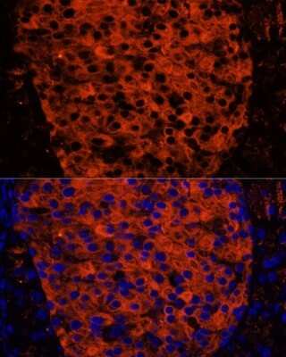 Immunohistochemistry: PLRP1 Antibody - Azide and BSA Free [NBP2-94066]