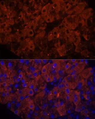 Immunohistochemistry: PLRP1 Antibody - Azide and BSA Free [NBP2-94066]