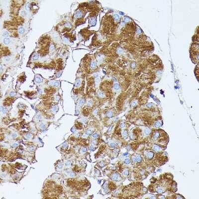 Immunohistochemistry-Paraffin: PLRP1 Antibody - Azide and BSA Free [NBP2-94066]