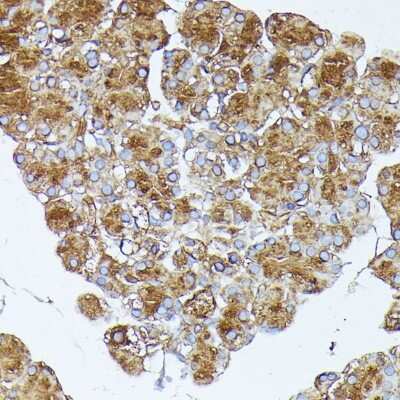 Immunohistochemistry-Paraffin: PLRP1 Antibody - Azide and BSA Free [NBP2-94066]