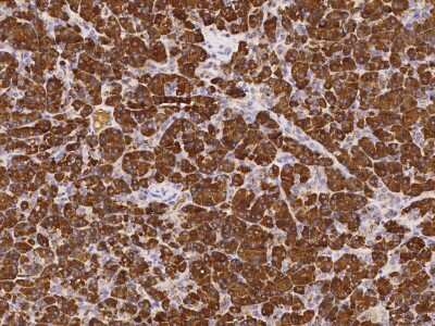 Immunohistochemistry-Paraffin: PLRP1 Antibody [NBP3-00156]