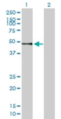 Western Blot: PLRP1 Antibody [H00005407-B01P]