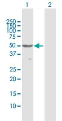 Western Blot: PLRP1 Antibody [H00005407-D01P]