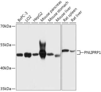 Western Blot: PLRP1 AntibodyAzide and BSA Free [NBP2-94066]