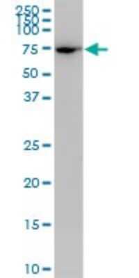 Western Blot: PLS1 Antibody (3G10) [H00005357-M04]