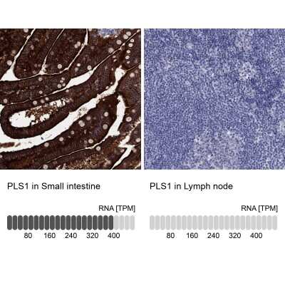 Immunocytochemistry/ Immunofluorescence: PLS1 Antibody [NBP3-17087]