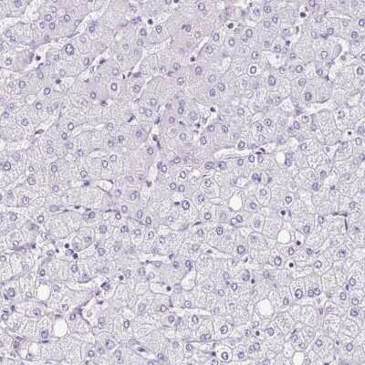 Immunohistochemistry-Paraffin: PLS1 Antibody [NBP2-30592]