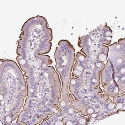 Immunohistochemistry-Paraffin: PLS1 Antibody [NBP2-30592]