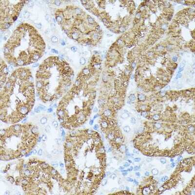 Immunohistochemistry-Paraffin: PLS1 Antibody - Azide and BSA Free [NBP2-94642]