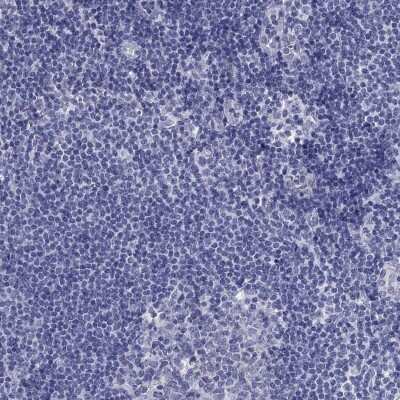Immunohistochemistry-Paraffin: PLS1 Antibody [NBP3-17087]