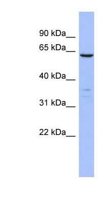 Western Blot: PLS1 Antibody [NBP1-56555]