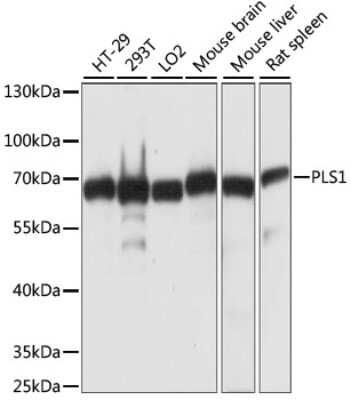 Western Blot: PLS1 AntibodyAzide and BSA Free [NBP2-94642]